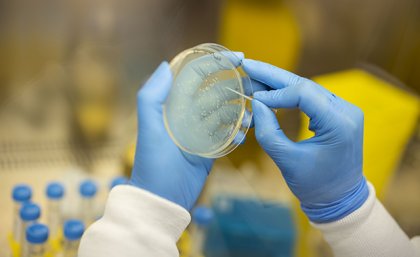 A pair of hands in surgical gloves examing a petri dish